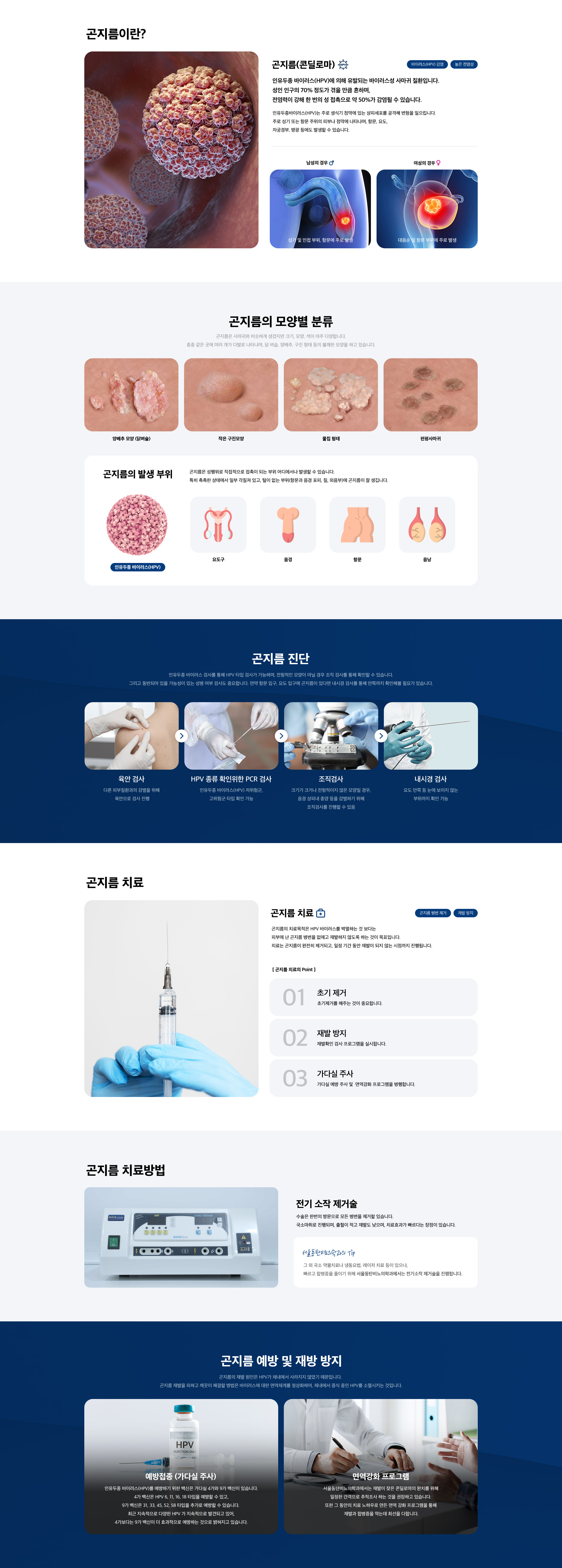 곤지름 (콘딜로마)